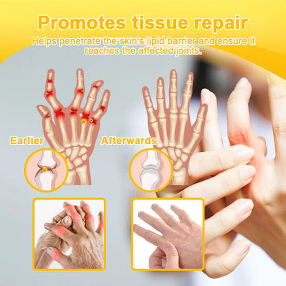 ICYLEAF@ Bee Venom Pain-Relief Bone Healing Cream 🎊🎊(Specially for older adults)