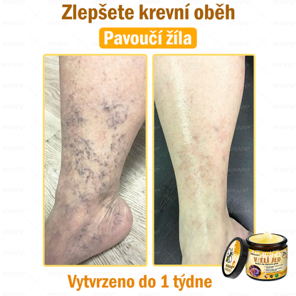 Dermatologicky a klinicky testováno🎁🐝APKAPK®Bee Venom Krém na obnovení pleti🐝 pomáhá při léčbě kožních problémů, jako jsou: vrásky, jizvy, pigmentové skvrny, strie, akné, psoriáza, ekzém, kožní změny, podráždění, záněty a další kožní problémy.