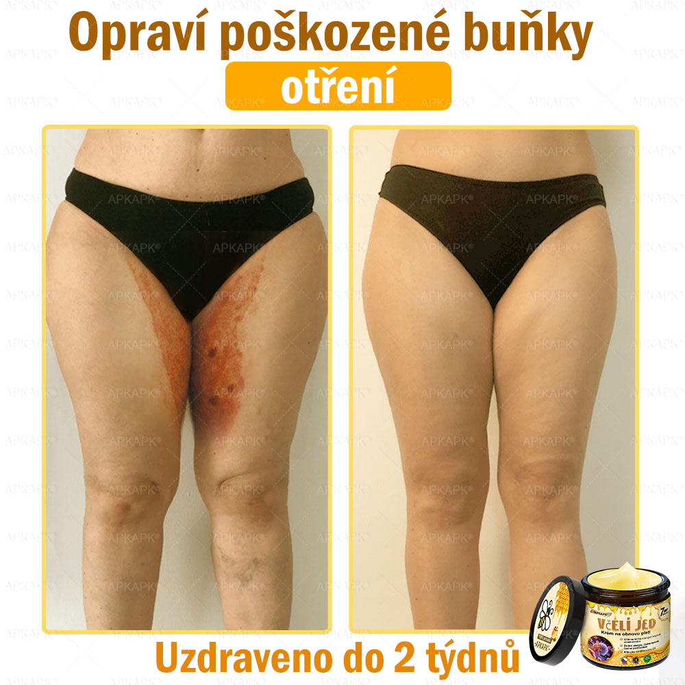 Dermatologicky a klinicky testováno🎁🐝APKAPK®Bee Venom Krém na obnovení pleti🐝 pomáhá při léčbě kožních problémů, jako jsou: vrásky, jizvy, pigmentové skvrny, strie, akné, psoriáza, ekzém, kožní změny, podráždění, záněty a další kožní problémy.