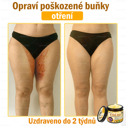 Dermatologicky a klinicky testováno🎁🐝APKAPK®Bee Venom Krém na obnovení pleti🐝 pomáhá při léčbě kožních problémů, jako jsou: vrásky, jizvy, pigmentové skvrny, strie, akné, psoriáza, ekzém, kožní změny, podráždění, záněty a další kožní problémy.