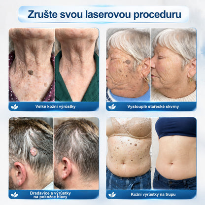 🎁 HISKIN® Zbývá pouze 5 balení! Získejte nyní extra 50% slevu! 🔥 Tato speciální nabídka brzy končí – využijte ji ještě dnes!