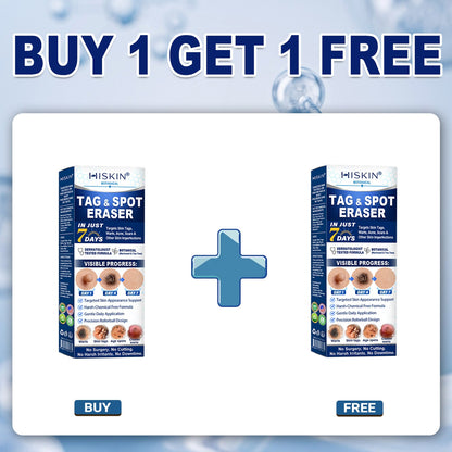 🔥 Save Up to 50% | HISKIN® Skin Tag & Spot Eraser Rollerball Pen | Fast & Gentle Skin Care