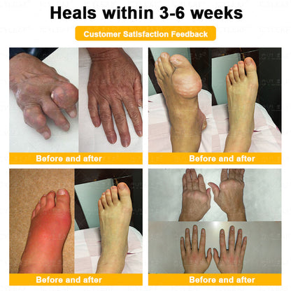 ICYLEAF@ Bee Venom Pain-Relief Bone Healing Cream 🎊🎊(Specially for older adults)
