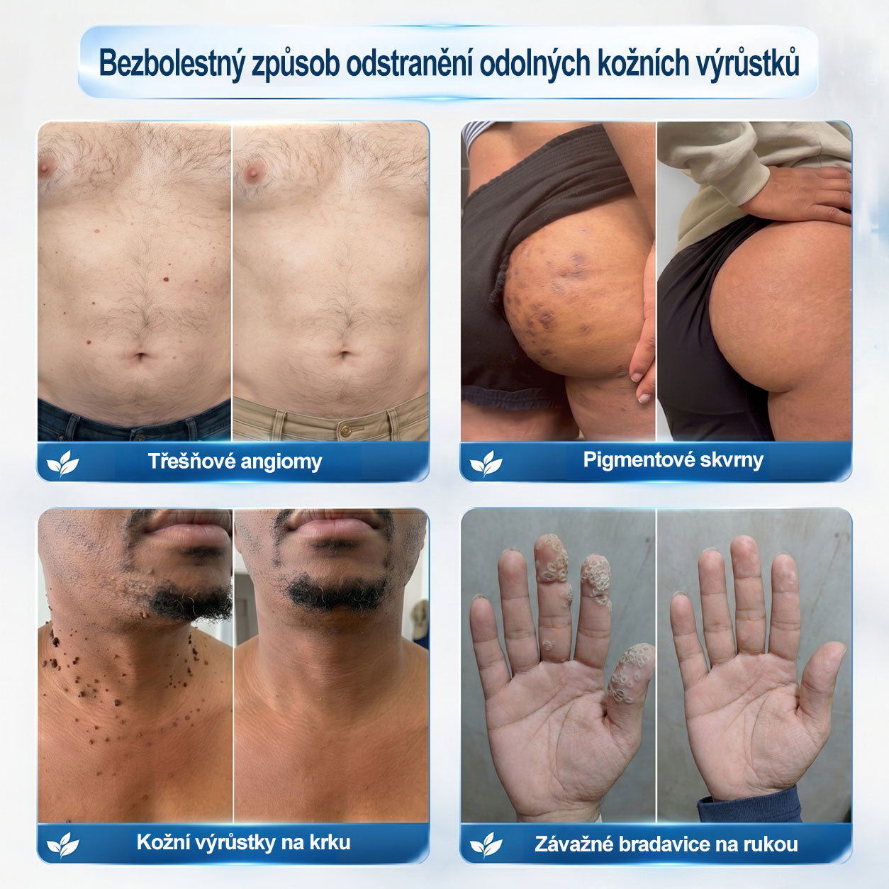 🎁 HISKIN® Zbývá pouze 5 balení! Získejte nyní extra 50% slevu! 🔥 Tato speciální nabídka brzy končí – využijte ji ještě dnes!