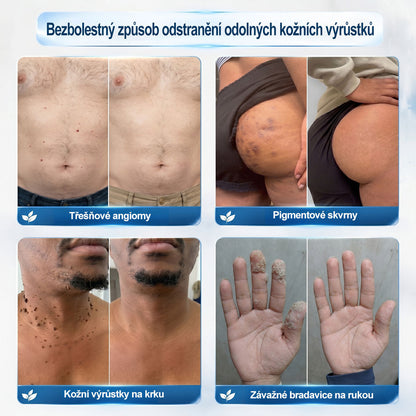 🎁 HISKIN® Zbývá pouze 5 balení! Získejte nyní extra 50% slevu! 🔥 Tato speciální nabídka brzy končí – využijte ji ještě dnes!