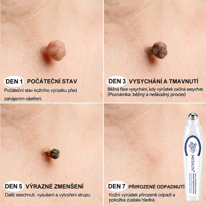 🎁 HISKIN® Zbývá pouze 5 balení! Získejte nyní extra 50% slevu! 🔥 Tato speciální nabídka brzy končí – využijte ji ještě dnes!