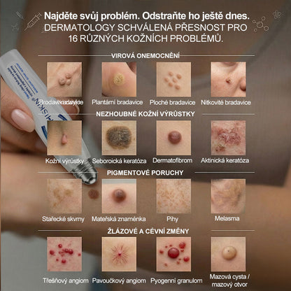 🎁 HISKIN® Zbývá pouze 5 balení! Získejte nyní extra 50% slevu! 🔥 Tato speciální nabídka brzy končí – využijte ji ještě dnes!