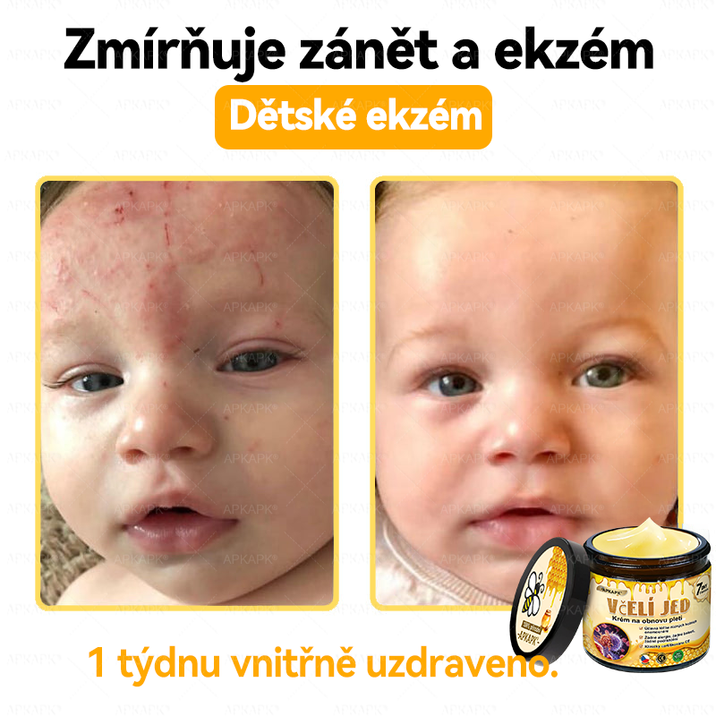 Dermatologicky a klinicky testováno🎁🐝APKAPK®Bee Venom Krém na obnovení pleti🐝 pomáhá při léčbě kožních problémů, jako jsou: vrásky, jizvy, pigmentové skvrny, strie, akné, psoriáza, ekzém, kožní změny, podráždění, záněty a další kožní problémy.