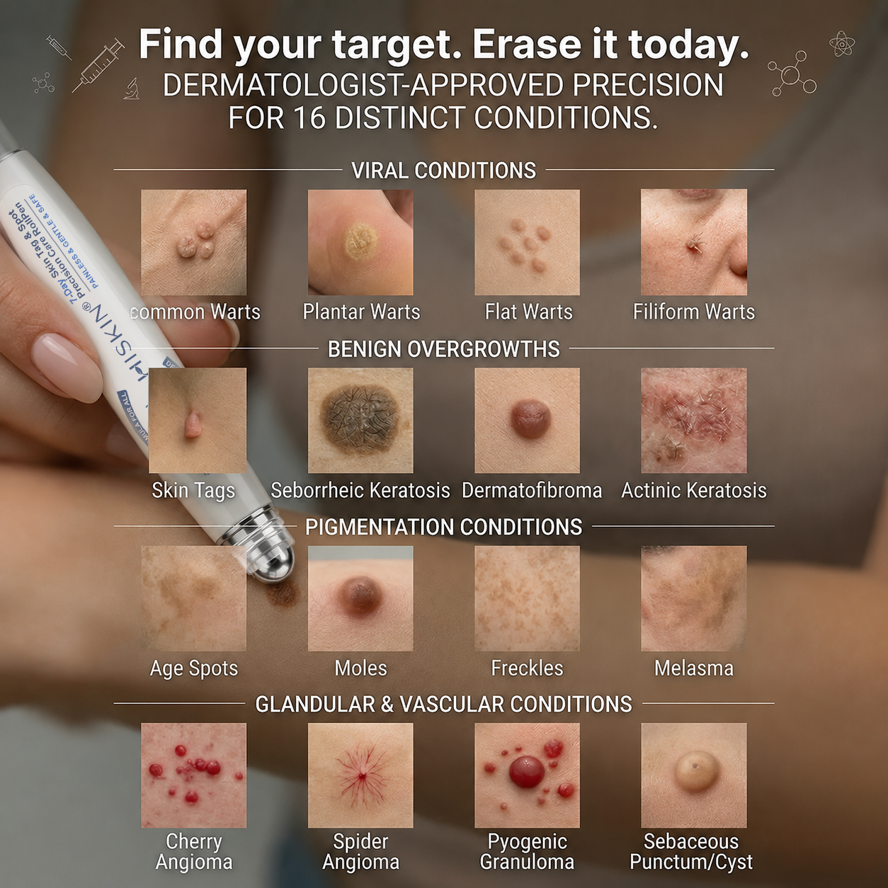 🔥 Save Up to 50% | HISKIN® Skin Tag & Spot Eraser Rollerball Pen | Fast & Gentle Skin Care