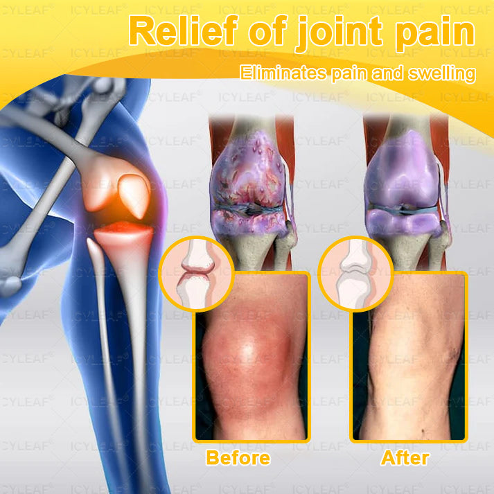 ICYLEAF@ Bee Venom Pain-Relief Bone Healing Cream 🎊🎊(Specially for older adults)