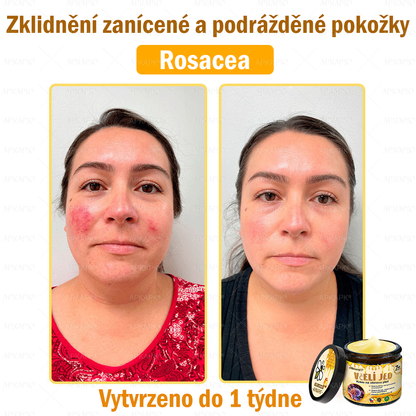 Dermatologicky a klinicky testováno🎁🐝APKAPK®Bee Venom Krém na obnovení pleti🐝 pomáhá při léčbě kožních problémů, jako jsou: vrásky, jizvy, pigmentové skvrny, strie, akné, psoriáza, ekzém, kožní změny, podráždění, záněty a další kožní problémy.
