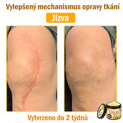 Dermatologicky a klinicky testováno🎁🐝APKAPK®Bee Venom Krém na obnovení pleti🐝 pomáhá při léčbě kožních problémů, jako jsou: vrásky, jizvy, pigmentové skvrny, strie, akné, psoriáza, ekzém, kožní změny, podráždění, záněty a další kožní problémy.