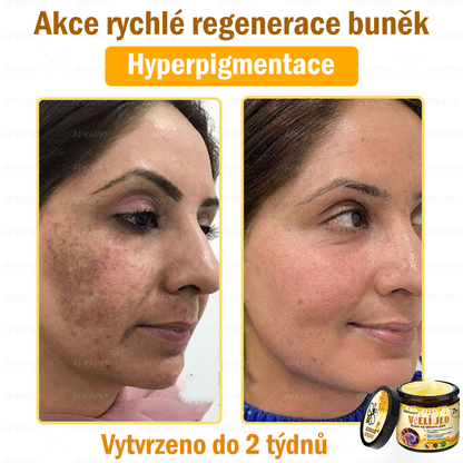 Dermatologicky a klinicky testováno🎁🐝APKAPK®Bee Venom Krém na obnovení pleti🐝 pomáhá při léčbě kožních problémů, jako jsou: vrásky, jizvy, pigmentové skvrny, strie, akné, psoriáza, ekzém, kožní změny, podráždění, záněty a další kožní problémy.